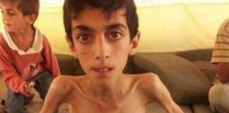 Bugün soframızda neler vardı? Açlıktan ölüyor masum insanlar! Suriye Madaya'da yaşanan açlık
