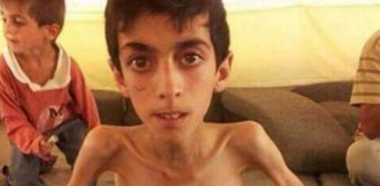 Bugün soframızda neler vardı? Açlıktan ölüyor masum insanlar! Suriye Madaya'da yaşanan açlık